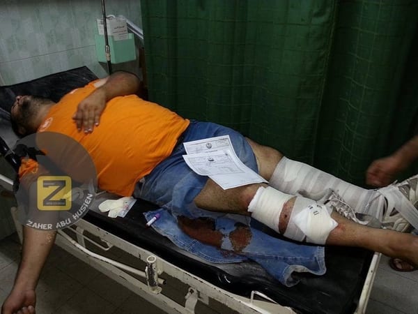 Fatah member Yusef Shaheen lies in hospital with both legs broken, courtesy of Hamas. (Photo: Facebook)